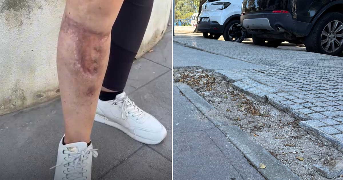 Vecina sufre un grave accidente en la plaza Manuel Cuenca por el mal estado de unos escalones