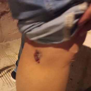 La Policía Local interviene tras la mordedura de un perro a una vecina en El Puerto