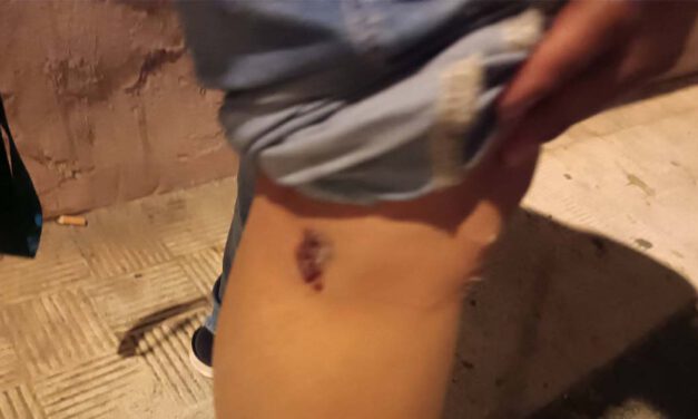 La Policía Local interviene tras la mordedura de un perro a una vecina en El Puerto
