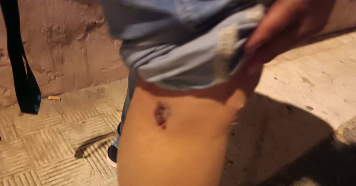 La Policía Local interviene tras la mordedura de un perro a una vecina en El Puerto